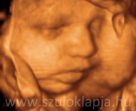 A magzat érzékszerveinek fejlődése 