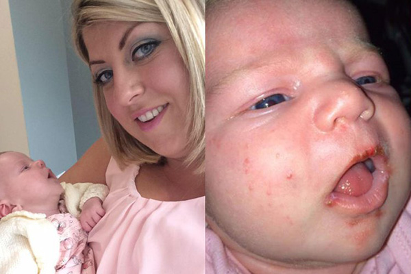 Ezért ne engedd, hogy puszilgassák a csecsemőd! Majdnem belehalt egy kisbaba