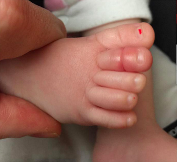 Ezért ne hagyd annyiban, ha sír a kisbabád! - Ijesztő dologról számolt be egy apuka