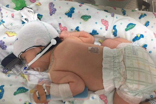 Császármetszés közben hunyt el az anyuka, miközben világra segítették kislányát - Szívszorító fotón az apuka és újszülött gyermeke