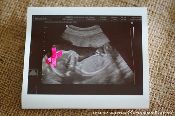 Kislányod születik vagy kisfiad? 13 aranyos fotós ötlet, hogyan jelentsd be a baba nemét a rokonságnak