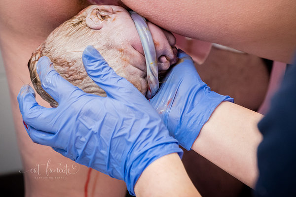 Az Év szülésfotója 2017: 12 gyönyörű fotó a szülés és születés csodájáról - Nézd meg, kiket díjazott a zsűri