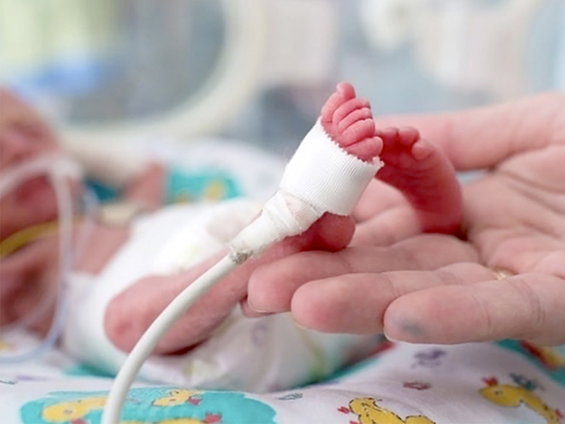 Csodát tettek az orvosok! Életben maradt a 23. hétre, 500 grammal született kisbaba - Csak akkora volt, mint egy golyóstoll