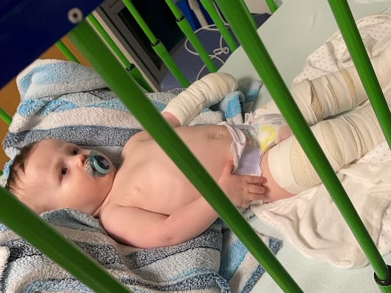 A bölcsődében szenvedett súlyos égési sérüléseket egy kisfiú, miután ráömlött egy vödör fertőtlenítőszer